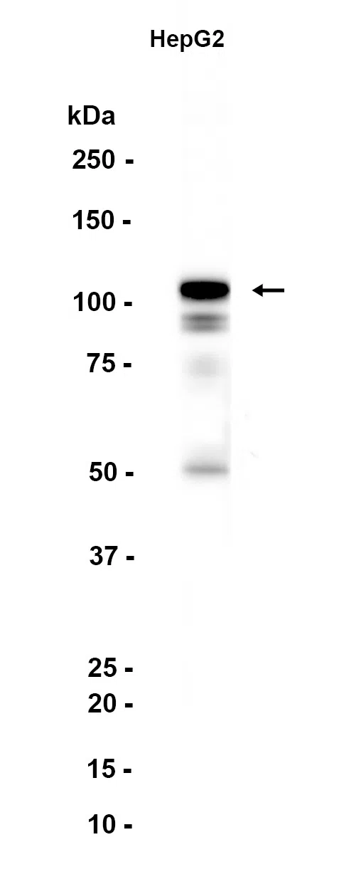 OSBPL9 Rabbit Monoclonal Antibody - Size: 50µl
