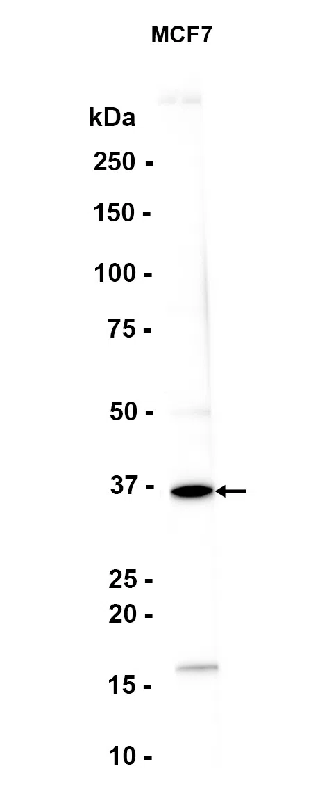 RRM2B Rabbit Monoclonal Antibody - Size: 100µl