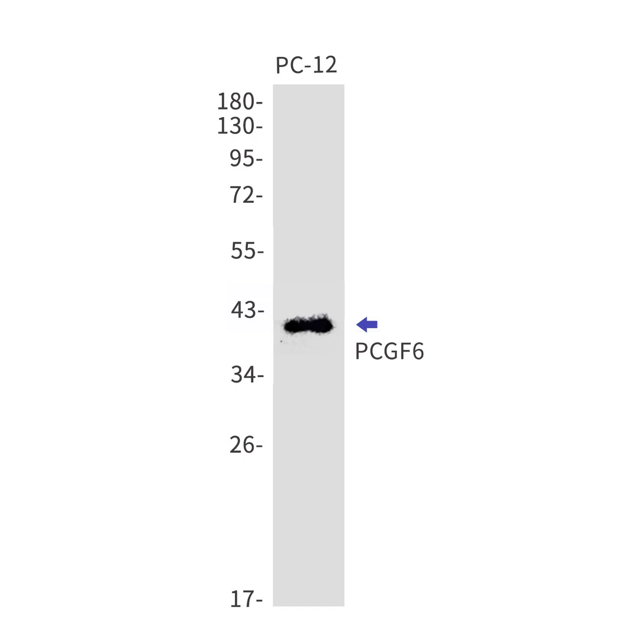 PCGF6 Rabbit Monoclonal Antibody - Size: 50µl