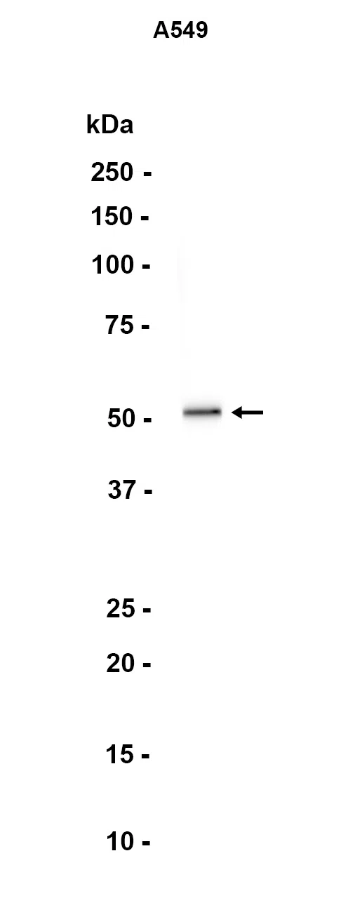 PPOX Rabbit Monoclonal Antibody - Size: 50µl
