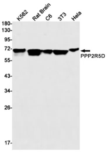 PPP2R5D Rabbit Monoclonal Antibody
