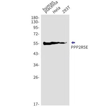 PPP2R5E Rabbit Monoclonal Antibody