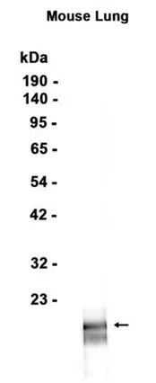 SFTPC Rabbit Monoclonal Antibody