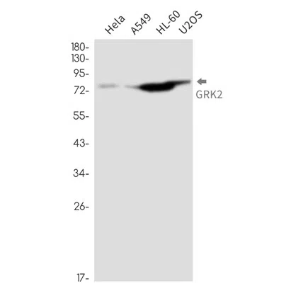 GRK2 Rabbit Monoclonal Antibody - Size: 50µl