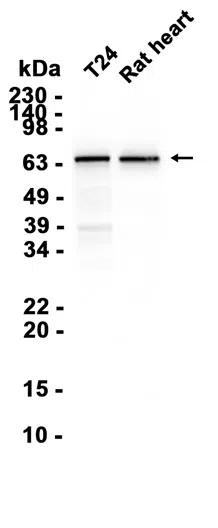 YTHDF2 Rabbit Monoclonal Antibody - Size: 100µl