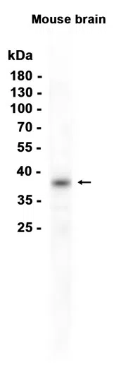 Olig2 Rabbit Monoclonal Antibody