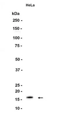 CDKN2A/p16INK4a Rabbit Monoclonal Antibody