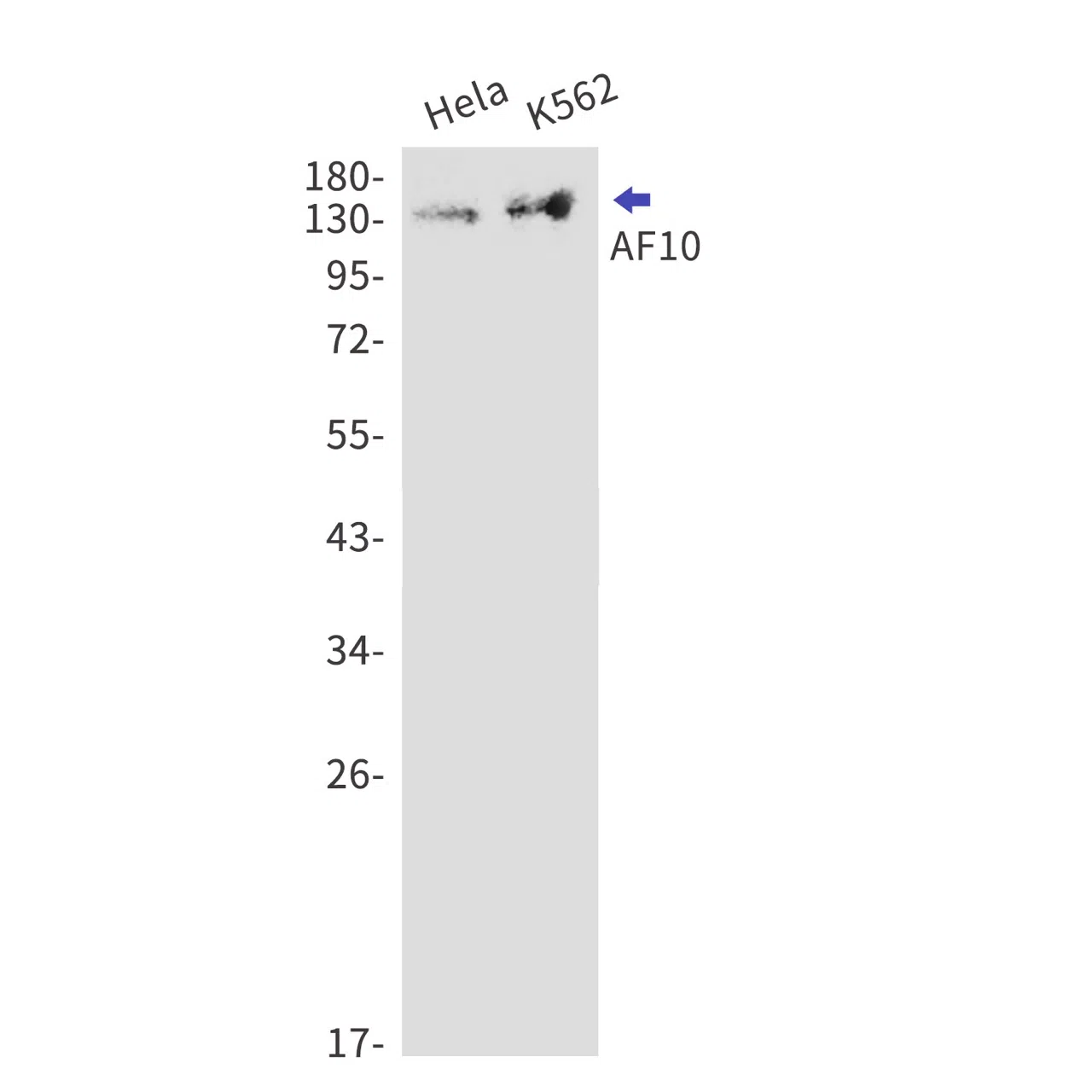 AF10 Rabbit Monoclonal Antibody - Size: 50µl