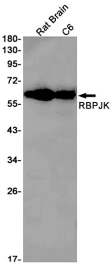 RBPJK Rabbit Monoclonal Antibody - Size: 50µl