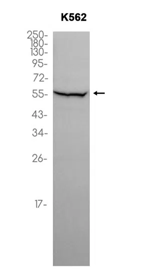 NAMPT Rabbit Monoclonal Antibody - Size: 100µl