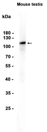 USP16 Rabbit Monoclonal Antibody - Size: 100µl