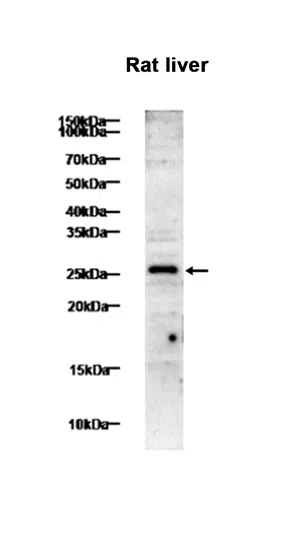 TNF alpha Rabbit Monoclonal Antibody - Size: 50µl