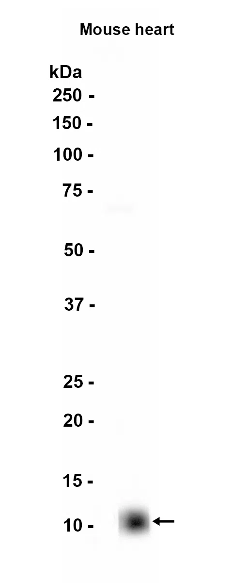 S100A1 Rabbit Monoclonal Antibody