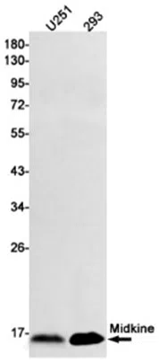 Midkine Rabbit Monoclonal Antibody - Size: 50µl