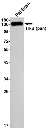 Trk B Rabbit Monoclonal Antibody - Size: 50µl