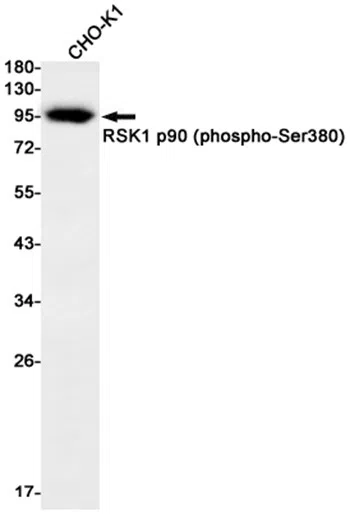 Phospho-RSK1 p90 (Ser380) Rabbit Monoclonal Antibody - Size: 50µl