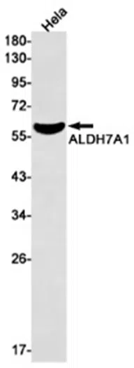 ALDH7A1 Rabbit Monoclonal Antibody - Size: 100µl