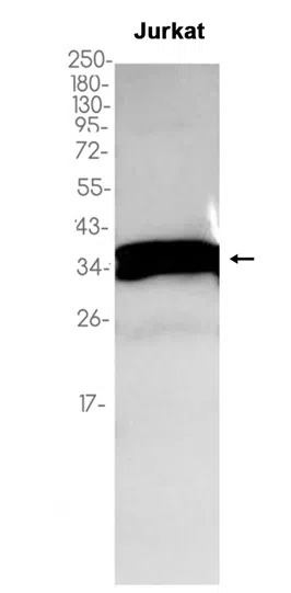 PPP2CA/B Rabbit Monoclonal Antibody