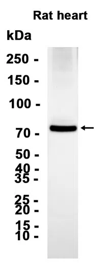 Phospho-PKC alpha (Thr497) Rabbit Monoclonal Antibody - Size: 50µl