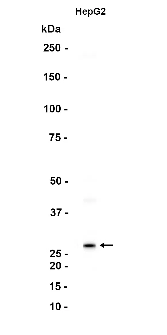 ANP32B Rabbit Monoclonal Antibody - Size: 100µl