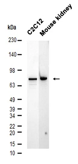 HNF1A Rabbit Monoclonal Antibody - Size: 100µl