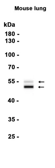 RAGE Rabbit Monoclonal Antibody - Size: 100µl