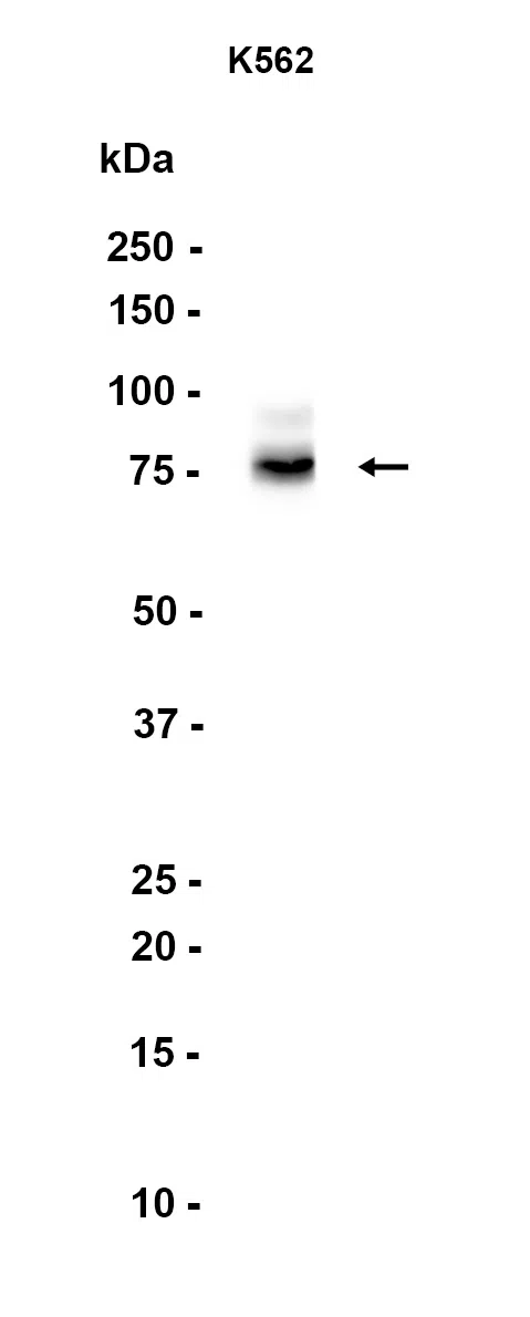GALNTL2 Rabbit Monoclonal Antibody - Size: 50µl