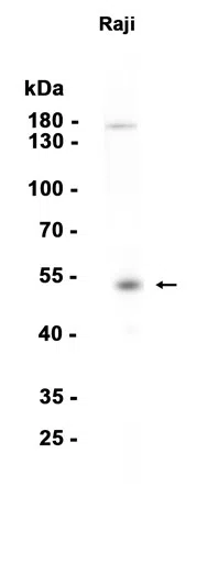 ETS1 Rabbit Monoclonal Antibody - Size: 50µl