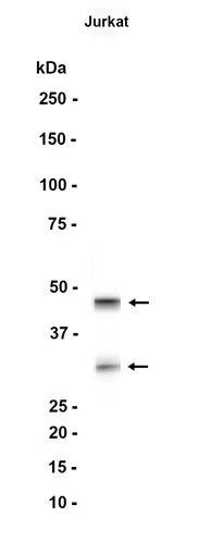 Caspase-2 Rabbit Monoclonal Antibody - Size: 50µl