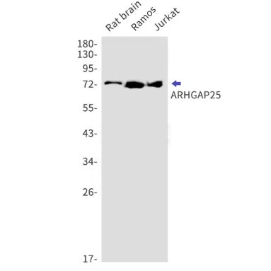 ARHGAP25 Rabbit Monoclonal Antibody - Size: 50µl