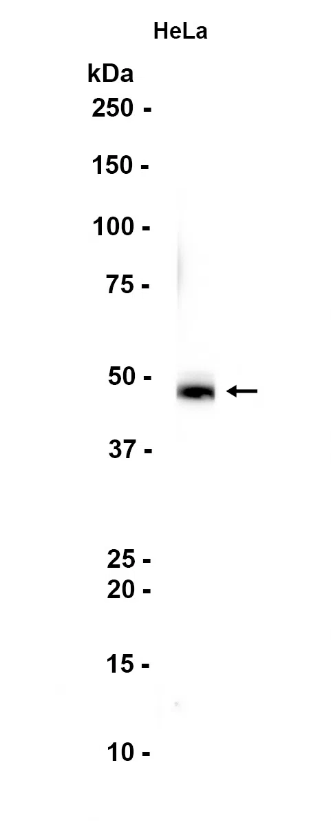 Beta Arrestin 2 Rabbit Monoclonal Antibody