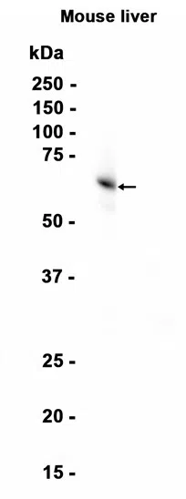 ALDH7A1 Rabbit Monoclonal Antibody - Size: 100µl
