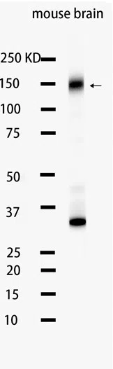 Trk (pan) Rabbit Monoclonal Antibody - Size: 50µl