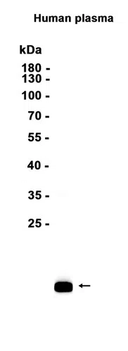 Prealbumin Rabbit Monoclonal Antibody - Size: 100µl