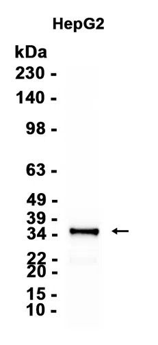 Lin28B Rabbit Monoclonal Antibody - Size: 100µl