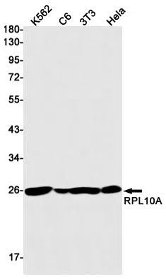 RPL10A Rabbit Monoclonal Antibody - Size: 50µl