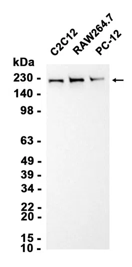 ZNFX1 Rabbit Monoclonal Antibody - Size: 50µl