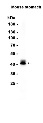 Vaspin Rabbit Monoclonal Antibody - Size: 100µl