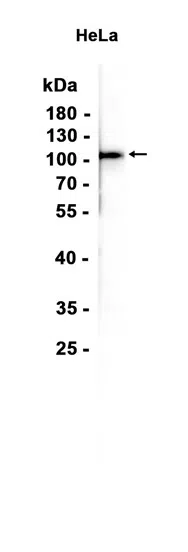 EEF2K Rabbit Monoclonal Antibody - Size: 100µl