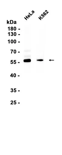 TCP1 eta Rabbit Monoclonal Antibody - Size: 50µl