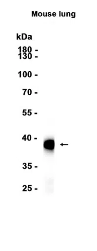 Podoplanin Rabbit Monoclonal Antibody - Size: 50µl