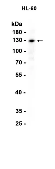 CD135 Rabbit Monoclonal Antibody